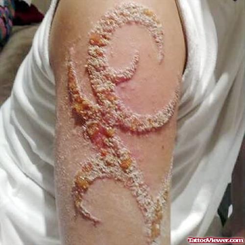 Extreme Henna Scar Tattoo