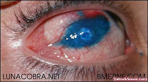Blue Tattoo Inside The Eye