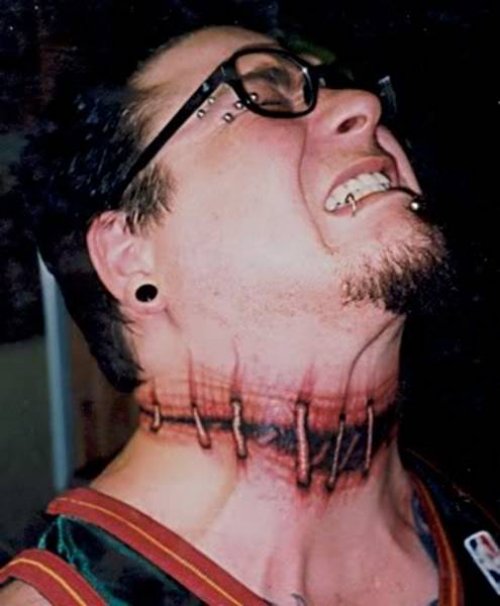 Extreme Stitches Tattoos On Man Neck